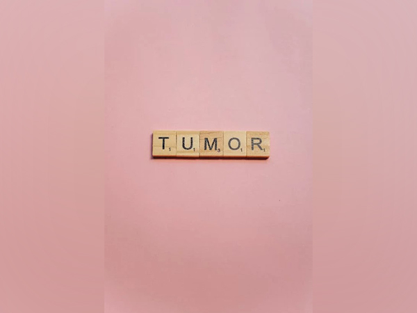 Researchers discover how artificial intelligence can be trained to detect tumour