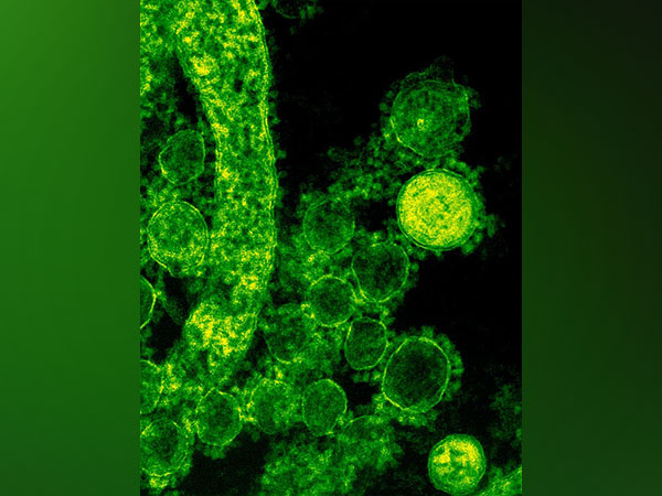 Scientists unearth potential viral resistance mechanism Scientists unearth potential viral resistance mechanism