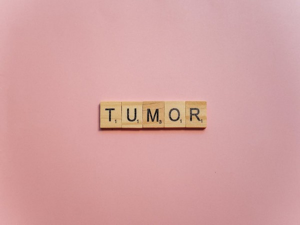 Study finds common mechanism tumours use to suppress immune responses