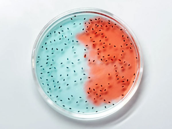 Researchers reveal how good friendships are associated with healthier gut microbiome