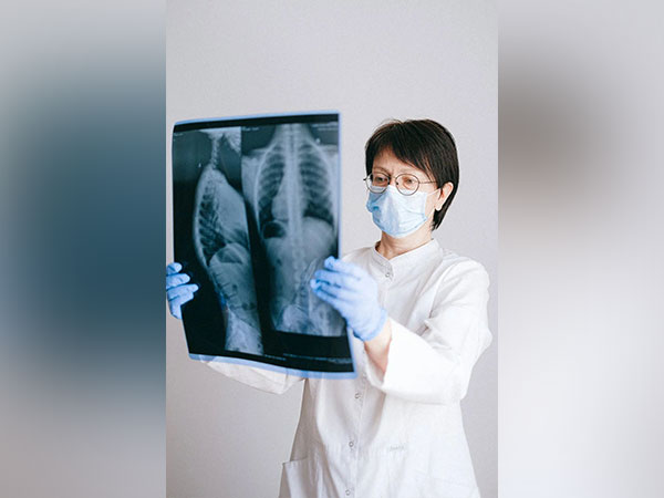 Lung cancer screening helps to increase survival rate of cancer patients Lung cancer screening helps to increase survival rate of cancer patients