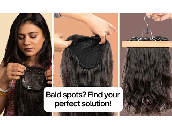 What's the Best Solution for Bald Spots? Hair Extensions, Wigs, or Hair Toppers Compared