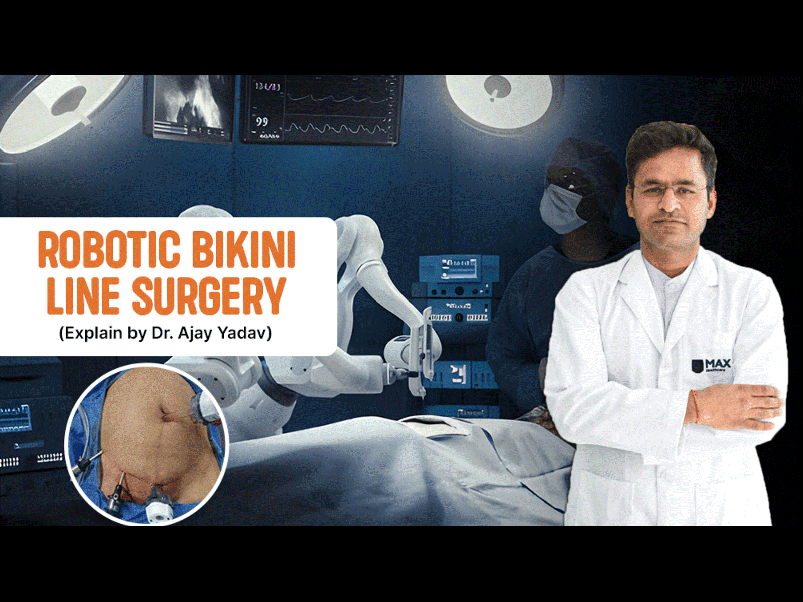 Robotic Bikini Line Surgery: A Modern Approach to Gallbladder Removal