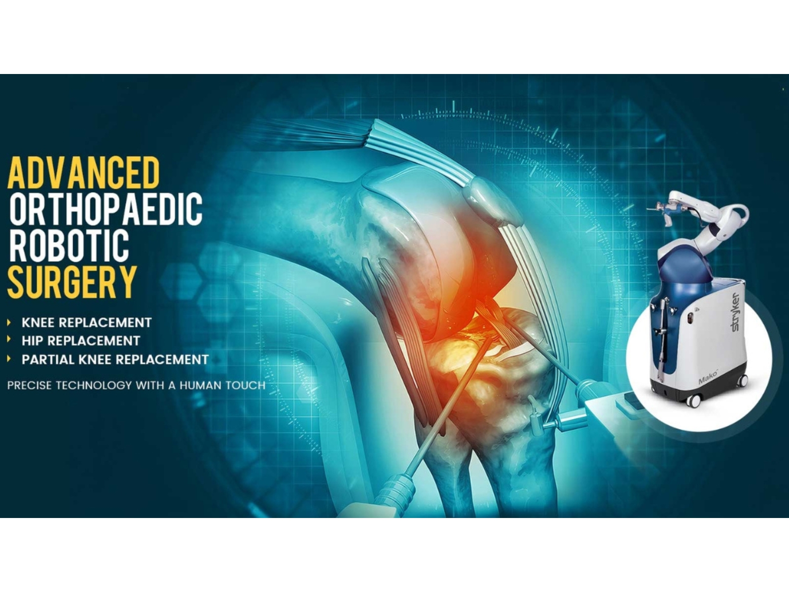 Advanced Robotic Orthopaedic Surgery Clinic at Jehangir Hospital, Pune