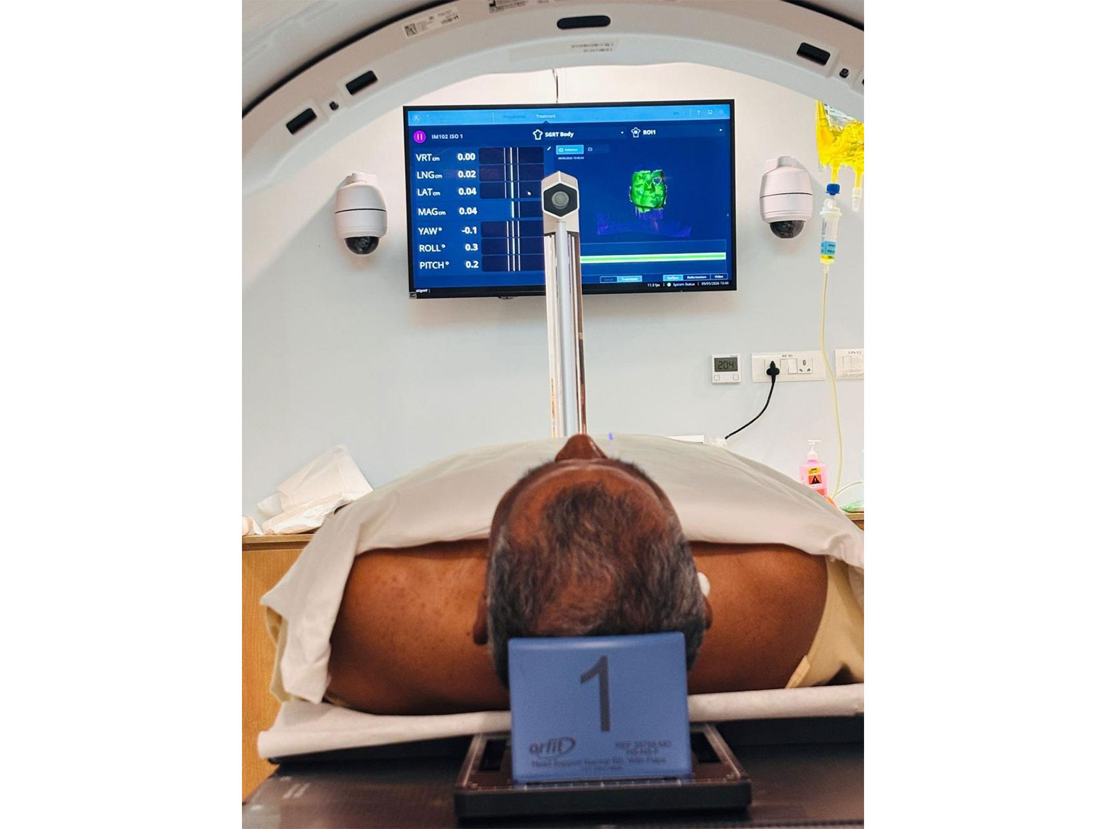 Sir HN Reliance Foundation Hospital achieves AI breakthrough in cancer care with mask-free, simulationless radiotherapy (Photo/Sir HN Reliance Foundation Hospital)