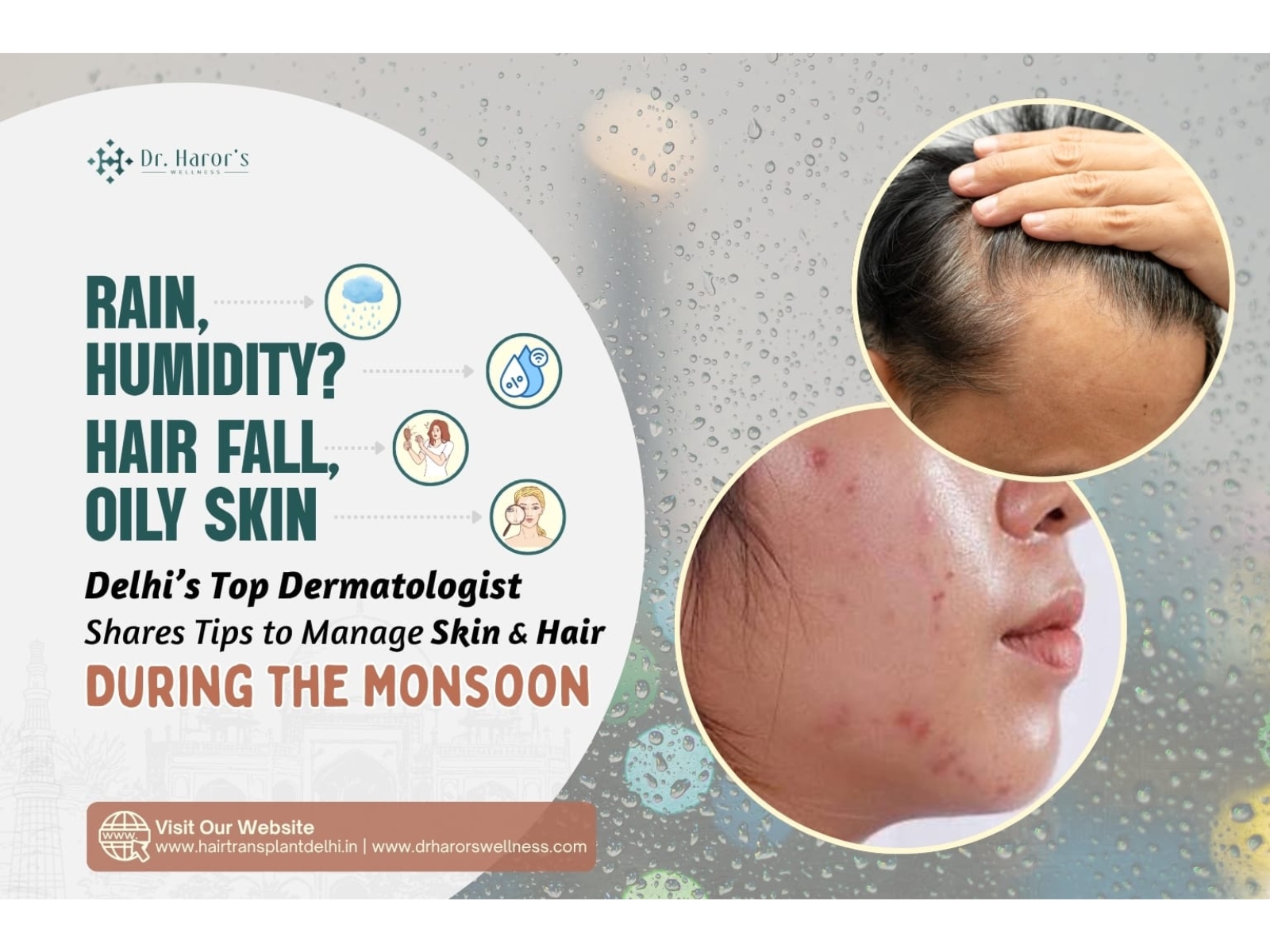 Rain, Humidity, Hair Fall, Oily Skin? Delhi's Top Dermatologist Shares Tips to Manage Skin & Hair During the Monsoon