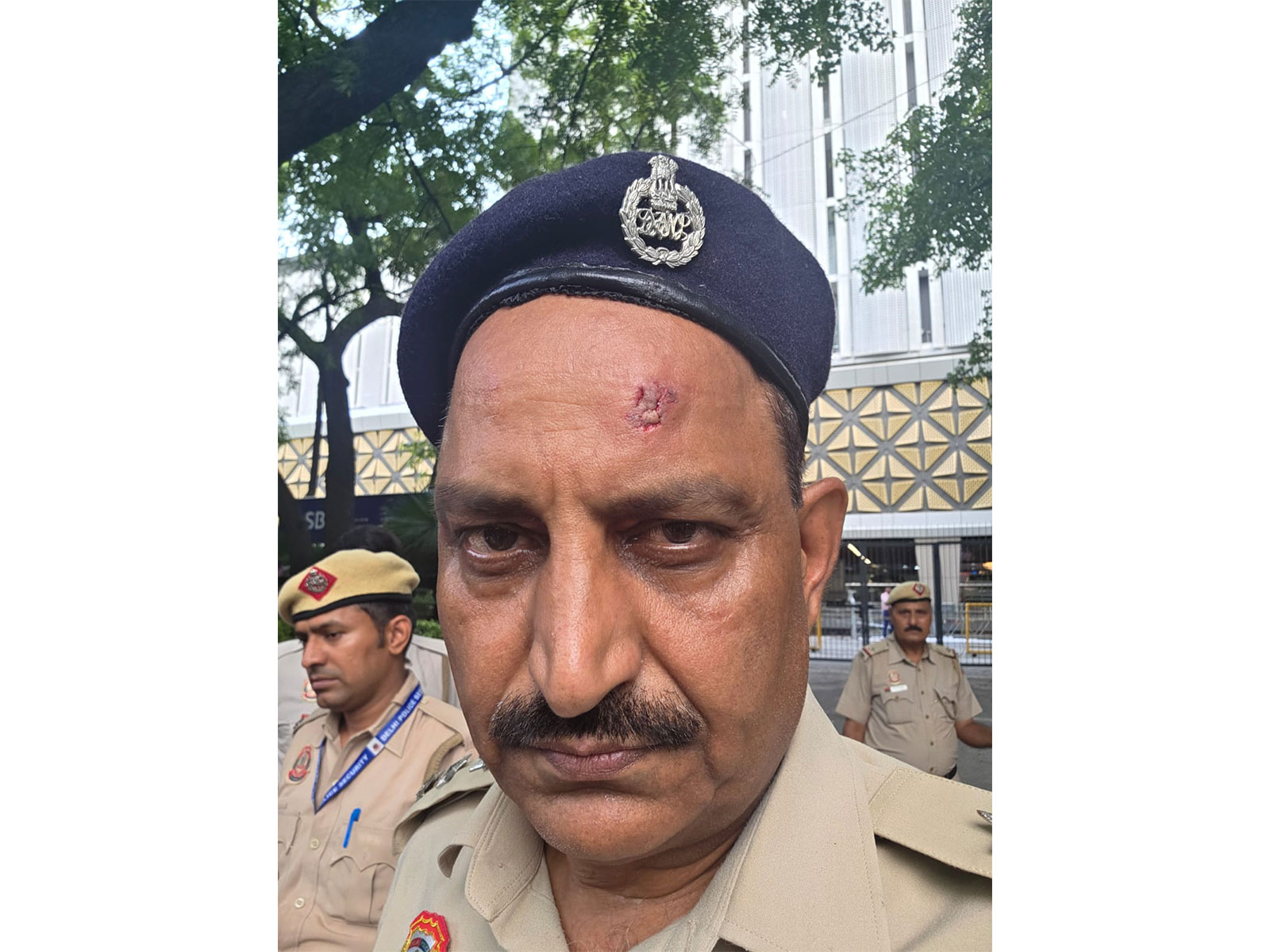 Injured Delhi Police ACP Jai Prakash (Photo/Delhi Police)
