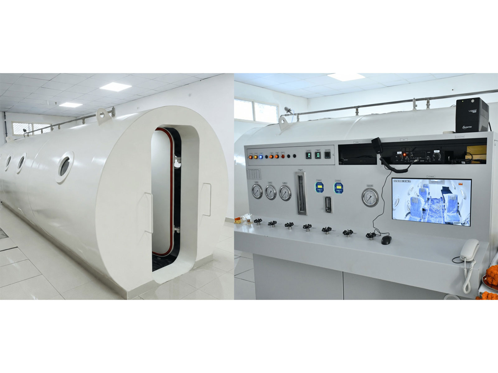 Bareilly's SRMS Institute Of Medical Sciences Brings Hyperbaric Oxygen Therapy (HBOT) To Uttar Pradesh | Opens New Possibilities For Specialized Patient Care