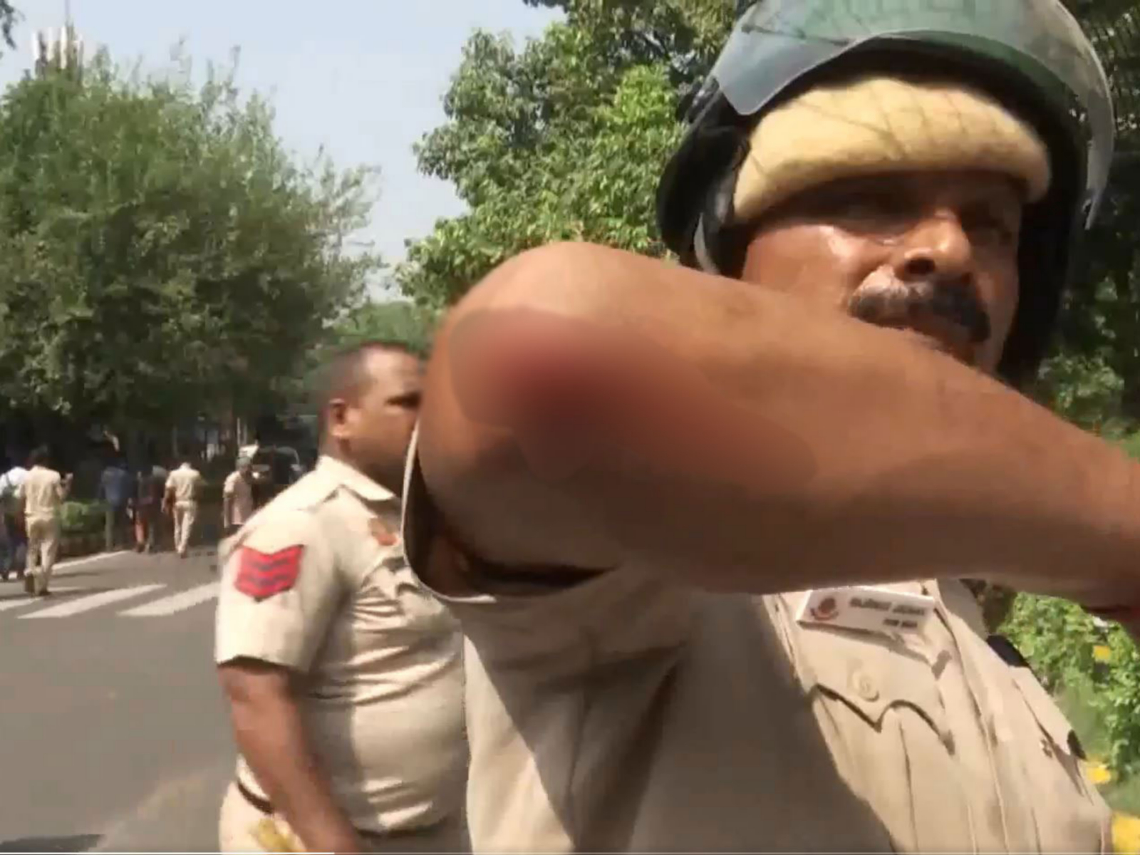 A Delhi Police official injured following reported stone-pelting and a scuffle during a protest near Connaught Place (Photo/ANI)