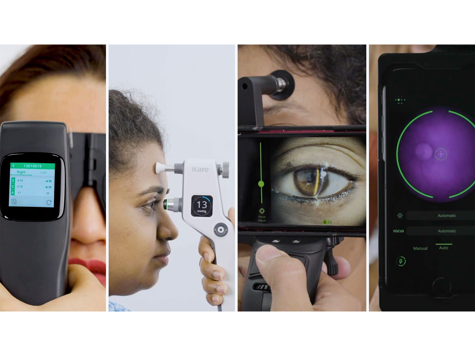 AI-powered eye screening to make healthcare more convenient (Photo/ANI)