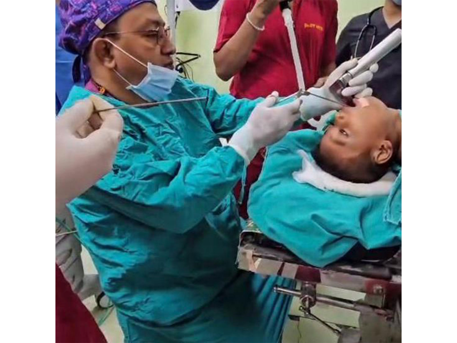 Doctors at AGMC, Agartala, remove coin from a four-year-old boy’s food pipe (Photo: AGMC & GBP Hospital)