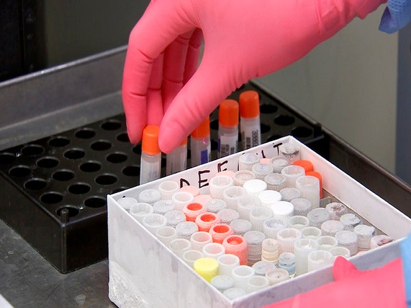 Over one lakh samples are being tested every day to detect coronavirus infection.