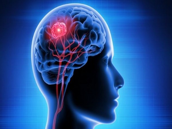 Unpleasant odour is processed more quickly in the brain than perceived quality