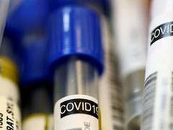 India on Saturday witnessed the biggest ever spike of 6,654 positive cases in the last 24 hours, taking the total number of COVID-19 cases to 1,25,101.