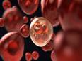 Cancer treatments might lead to accelerated cellular aging: Study - Vimarsana News