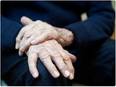 Lower risk of Parkinson's disease associated with prostate medication - Vimarsana News