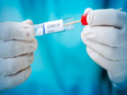 Pak's Punjab witnessing coronavirus cases with multiple COVID-19 strains: Study - Vimarsana News