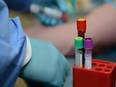 Regeneron antibody cocktail 'helps prevent' symptomatic Covid-19: Drugmaker - Vimarsana News