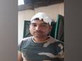 BSF soldier injured in attack by miscreants in Tripura - Vimarsana News