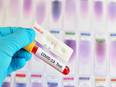 Over 13,000 coronavirus variants detected in Russia, says vaccine developer - Vimarsana News