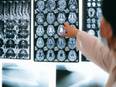 Researchers discover potential to reverse ageing in brain - Vimarsana News