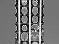 Researchers develop new drug-delivery system to treat brain disorders - Vimarsana News