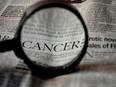 Screening for ovarian cancer did not reduce deaths during study - Vimarsana News
