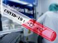 Delta variant prime suspect in COVID-19 cases across Varanasi: Study - Vimarsana News