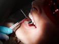 Demand for teeth whitening in India increased in past decade - Vimarsana News