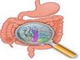 'Good' bacteria show promise for clinical treatment of Crohn's disease, ulcerative colitis - Vimarsana News