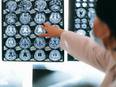 Newly discovered stem cell resting phase could put brain tumours to sleep - Vimarsana News