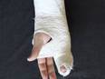 Bone fracture risk increases due to decline of critical enzymatic processes - Vimarsana News