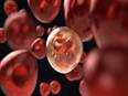 New computational technique differentiates between cancer and normal cells within tumour samples: Study - Vimarsana News