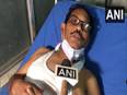 Bengal BJP MP alleges attack by 'TMC goons', says 'no rule of law' in state - Vimarsana News