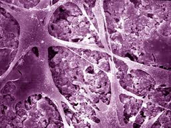 Stem cells from a patient's bone marrow could be cultured on the sheet and adaptively wrap around the bone during an operation Stem cells from a patient's bone marrow could be cultured on the sheet and adaptively wrap around the bone during an operation