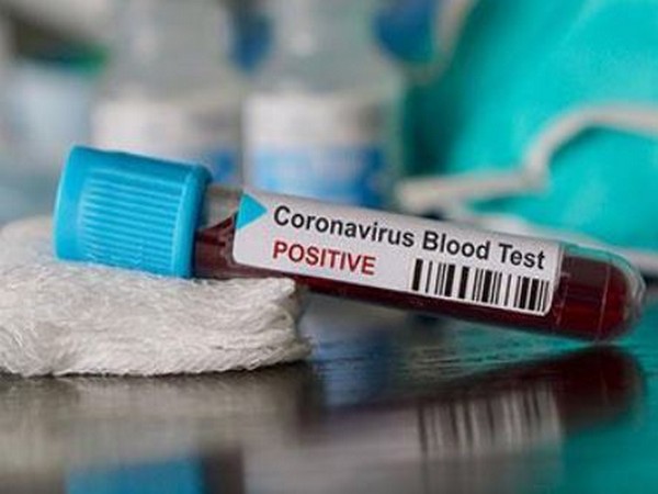 According to the Union Ministry of Health and Family Welfare, the total number of positive coronavirus cases in the country now stands at 694 and 16 deaths. According to the Union Ministry of Health and Family Welfare, the total number of positive coronavirus cases in the country now stands at 694 and 16 deaths.