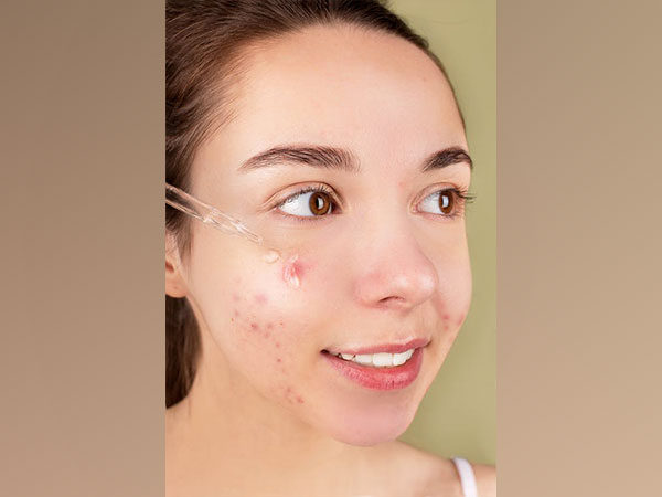 Researchers discover new method for treating skin infections and wounds