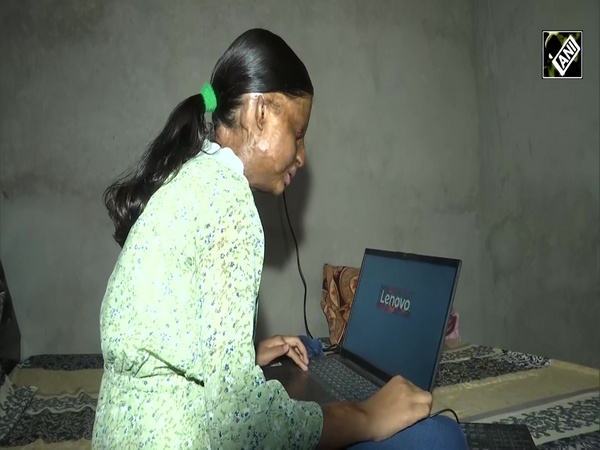 Acid attack survivor tops school with 95.02% in Class 10 CBSE board