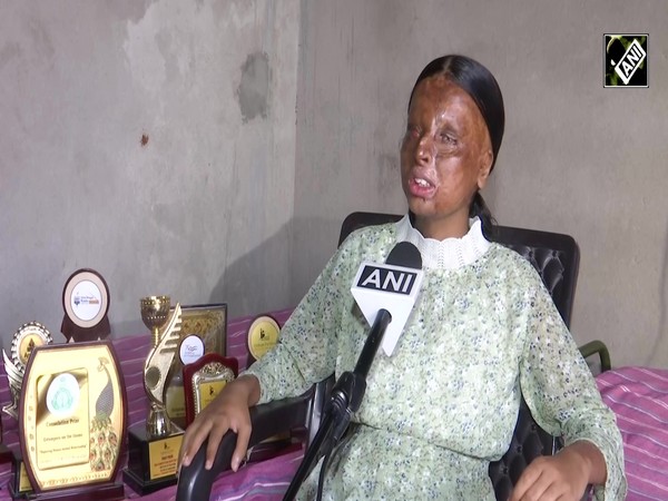 Chandigarh : 15 साल की एसिड अटैक सर्वाइवर ने 10वीं में टॉप कर माता-पिता का नाम किया रौशन
